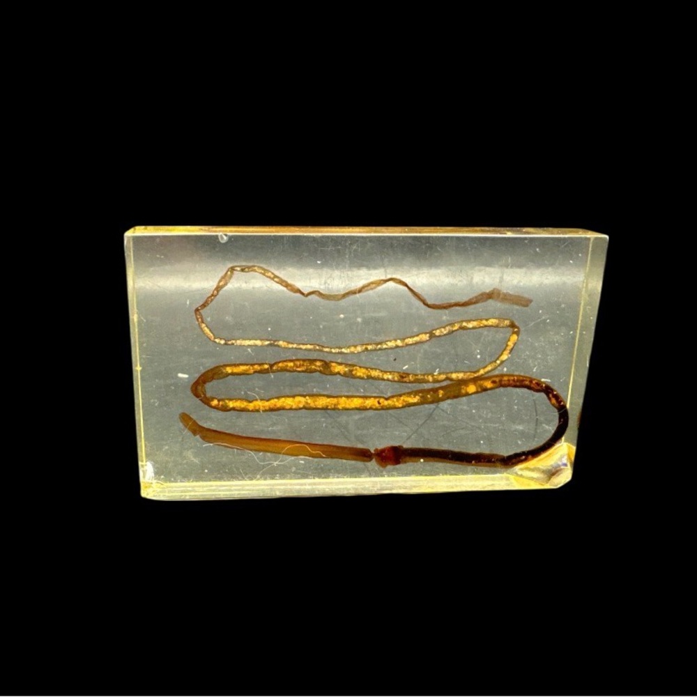 Vintage Clear Acrylic Resin Medical Scientific Specimen - Picture 2 of 4